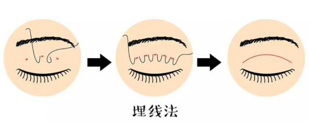 二、王莉莉医生与其他沈阳眼部整形医生客观对比