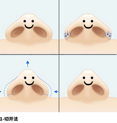 关于价格透明与避坑，你必须知道的几件事