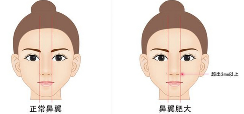 潍坊正规整形医院推荐哪家做鼻子自然？华美创和、坤娜自然有精致